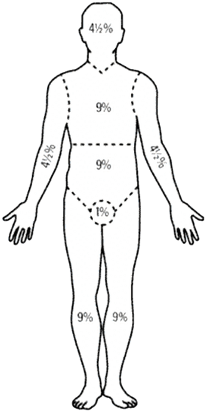인체 전면 다이어그램
